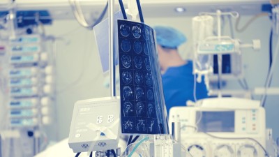 Patient's CT scan in the intensive care unit