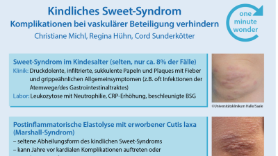 One Minute Wonder: Komplikationen beim kindlichen Sweet-Syndrom