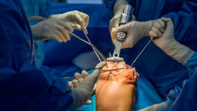 Knochensäge im Einsatz bei Knie-TEP