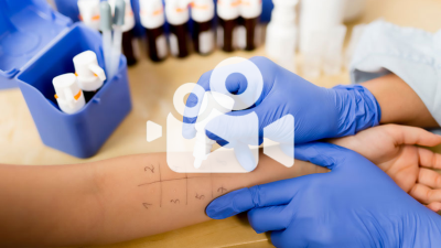 Allergie-Test