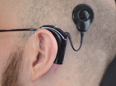 Mann mit Cochlea-Implantat