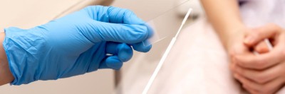 Ein Abstrich vom Gebärmutterhals wird auf ein Objektivträger geschmiert