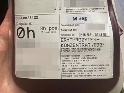 Erythrozytenkonzentrat Blutgruppe 0h