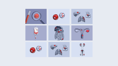 Case-Based Insights teaser image