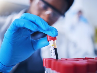 Clinician looking at blood samples