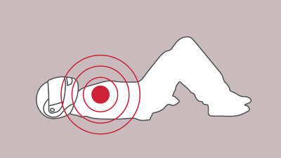 Traumatologische Notfälle