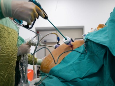 Adipositaschirurgie