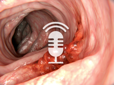 Springer Medizin Podcast - Darmkrebsvorsorge