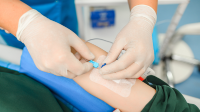 Placing a catheter for administering IV drugs