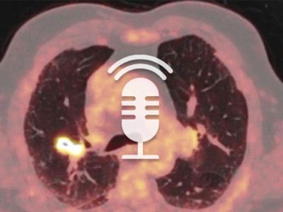 Springer Medizin Podcast - CUP-Syndrom