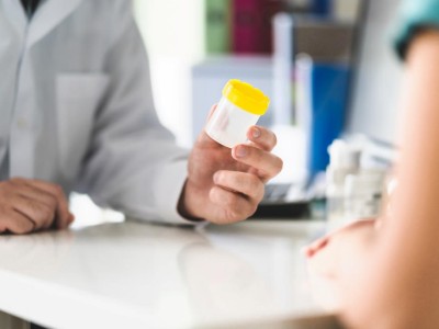 Arzt reicht Patientin Urinbecher
