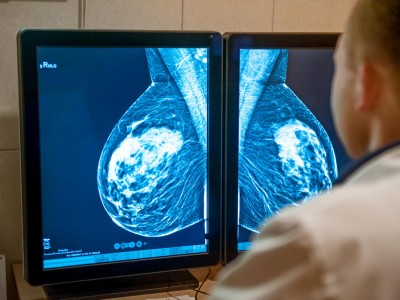 Arzt untersucht Mammogramm