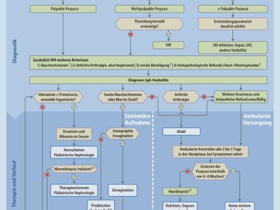 IgA-Vaskulitis | Handlungsempfehlung zur S2k-Leitlinie Immunglobulin A ...