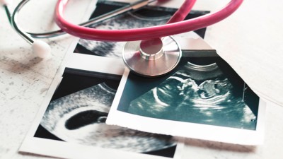 Ultraschallbilder und Stethoskop 