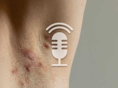 ZFA TALKS - Acne inversa