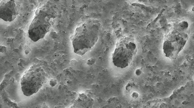 Offene Dentintubuli bei 10.000-facher Vergrößerung