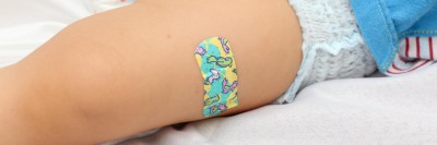 Säugling mit Pflaster am Oberschenkel nach Impfung