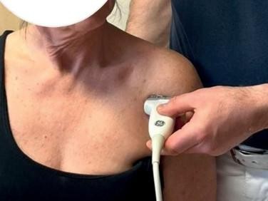 Position des Schallkopfs ventral an der Schulter