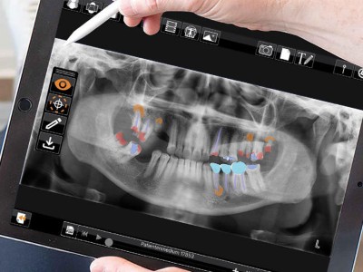 Tablet auf dem ein Röntgenbild der Kiefer abgebildet ist. Strukturen und Pathologien sind farbig markiert