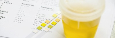 Urinbecher und Urinanalyse-Streifen