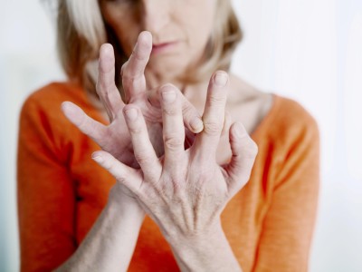 Rheumatoide Arthritis in den Händen
