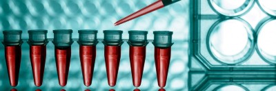 Biomarker