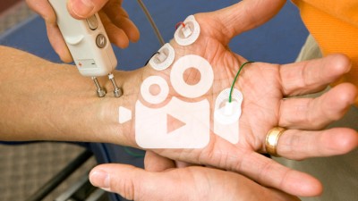 Nervenstimulation an Hand und Handgelenk