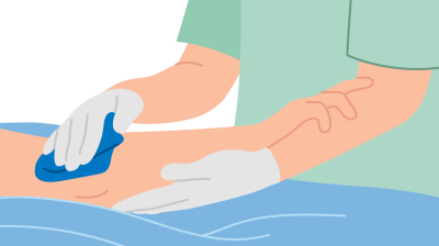 Stimulieren eines Unterarms