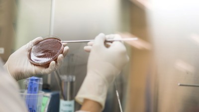 Petri dish in microbiology lab