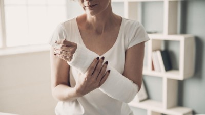 Woman with a broken arm