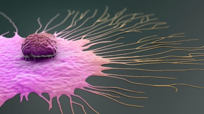 3D illustration of a migrating breast cancer cell