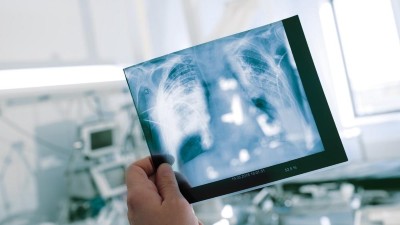 Leitthema: Pneumologische Intensivmedizin