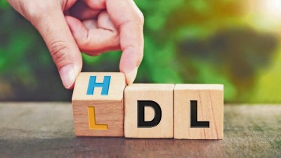 HDL