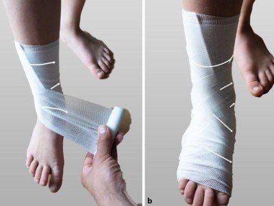 Anlegen eines Fixierverbands am Knöchel