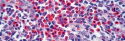 Lymphon
