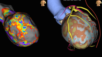 Leitthema: Teamwork Rhythmologie und Herzinsuffizienz - Titelbild