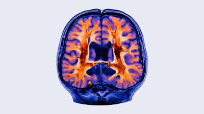 Navigating neuroimaging in Alzheimer’s care: Practical applications and strategies for integration