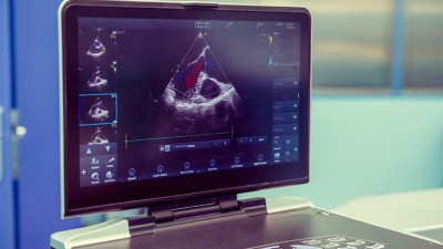 Ultrasound