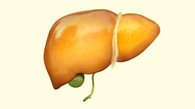 3D illustration of a steatotic liver