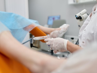 Gynäkologische Untersuchung mit Spekulum