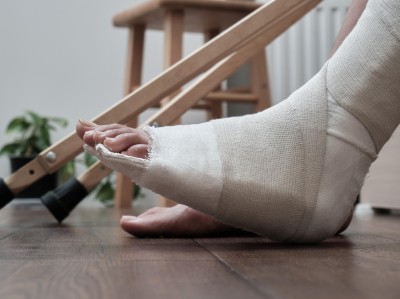 Gebrochener Fuß im Gips