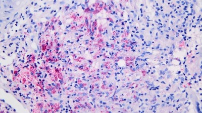 Leitthema: Systemtherapien - Titelbild