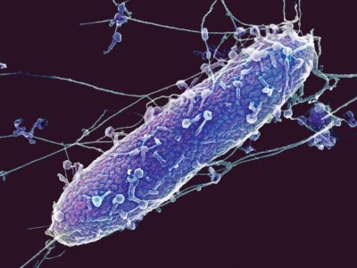 Bakteriophagen (hellblau) greifen ein Pseudomonas-aeruginosa-Baktierum (lila) an