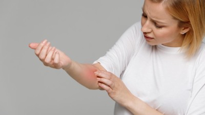 Frau kratzt sich am Unterarm