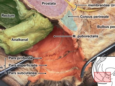 Formalinfixiertes Humanpräparat des analen Sphinkterapparats
