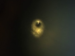 Hinterkapseldelle im Spiegelbezirk