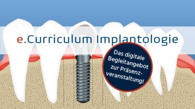 e.Curriculum Implantologie