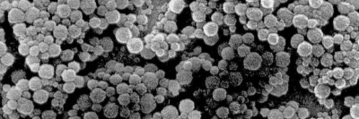 Rasterelektronenmikroskopische Aufnahme von Nanopartikeln