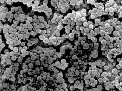 Rasterelektronenmikroskopische Aufnahme von Nanopartikeln