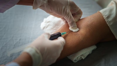 This image is a close up photograph of a blood sample being taken from a patient
